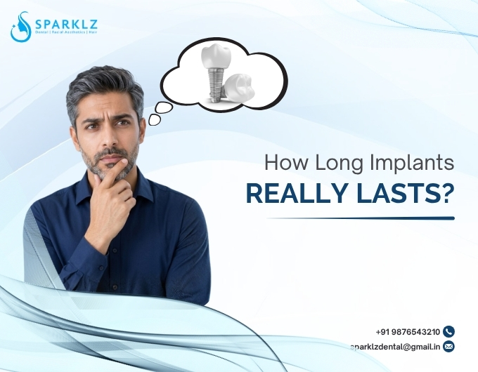 How long do implants REALLY last?