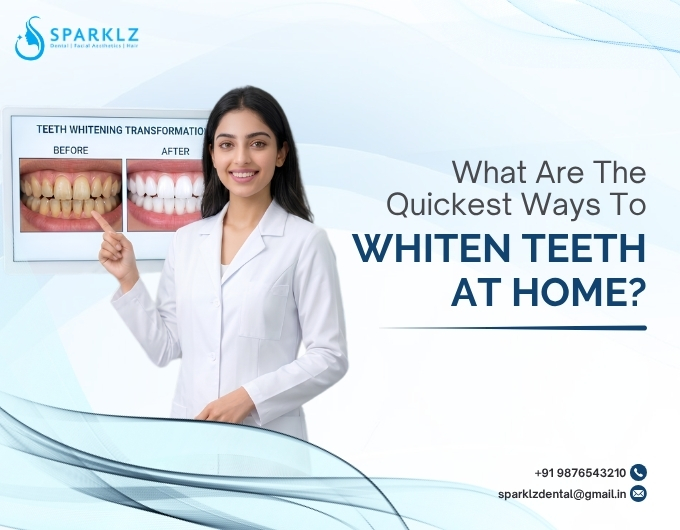 What are the quickest ways to whiten teeth at home?